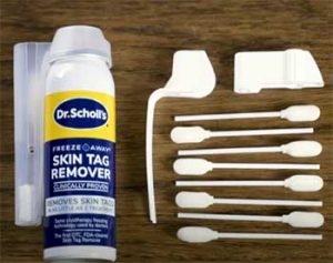 Read more about the article Dr. Scholl’s Skin Tag Remover Reviews: My Personal Experience