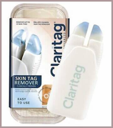 cryogen skin tag remover