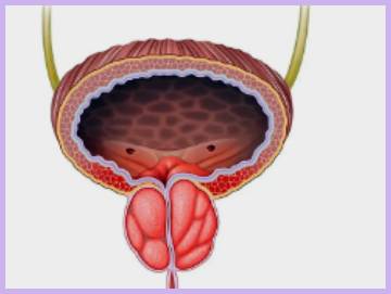 aquablation prostate