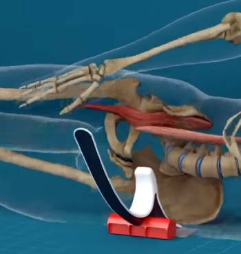 hip hook alternative