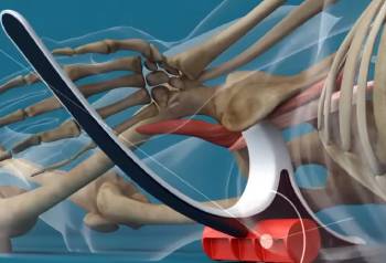 hip hook alternative