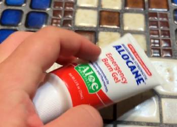 alocane burn gel