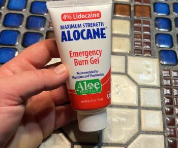 alocane burn gel