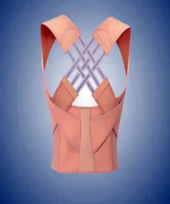 corecare posture corrector