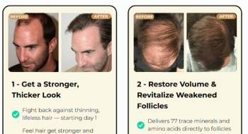 moerie hair growth pills