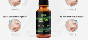 natura skin tag remover