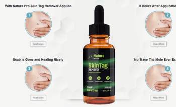 natura skin tag remover
