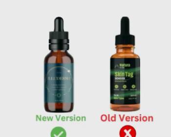 natura pro skin tag remover