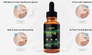 Read more about the article Natura Pro Skin Tag Remover Reviews From My Personal Experience