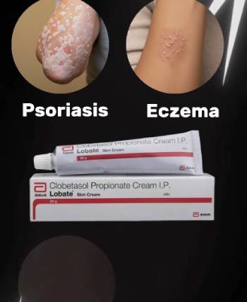 why is clobetasol so expensive