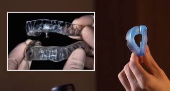 honex anti snoring mouthpiece